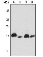 NDUFB11 Rabbit Polyclonal Antibody