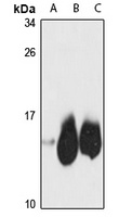 NDUFB2 Rabbit Polyclonal Antibody