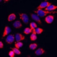 NFE2L1 Rabbit Polyclonal Antibody