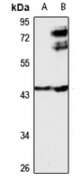 NFIX Rabbit Polyclonal Antibody