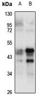NFKBIL1 Rabbit Polyclonal Antibody
