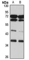 NGRN Rabbit Polyclonal Antibody