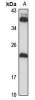 NHP2 Rabbit Polyclonal Antibody