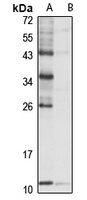 NHP2L1 Antibody