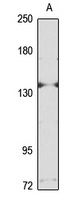 NLRP5 Rabbit Polyclonal Antibody