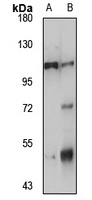 NLRP6 Rabbit Polyclonal Antibody