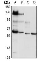 NOX3 Rabbit Polyclonal Antibody