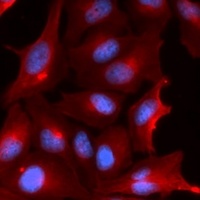 NQO2 Rabbit Polyclonal Antibody