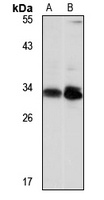 NSMCE1 Rabbit Polyclonal Antibody