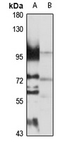 NSUN2 Antibody