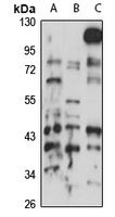 NSUN4 Rabbit Polyclonal Antibody