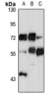 NT5C2 Rabbit Polyclonal Antibody