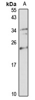 NUDT16 Antibody
