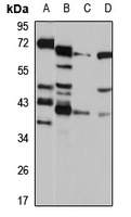 NUDT9 Rabbit Polyclonal Antibody