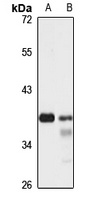 NUP35 Rabbit Polyclonal Antibody