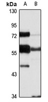 NUP50 Rabbit Polyclonal Antibody