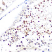 NUP50 Rabbit Polyclonal Antibody