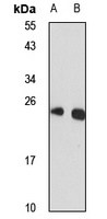 OSTC Rabbit Polyclonal Antibody