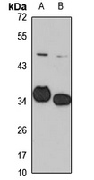 OTP Rabbit Polyclonal Antibody
