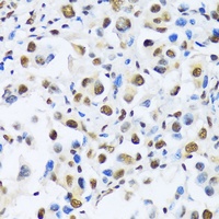 OTP Rabbit Polyclonal Antibody