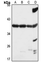 OTUD6B Rabbit Polyclonal Antibody