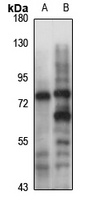 PADI2 Rabbit Polyclonal Antibody