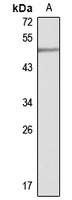 PARL Rabbit Polyclonal Antibody