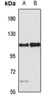 PARP10 Rabbit Polyclonal Antibody