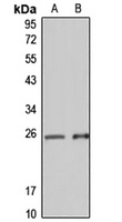 PCNP Rabbit Polyclonal Antibody