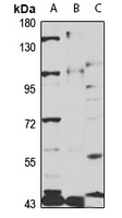 PC5 Rabbit Polyclonal Antibody