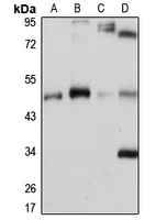 PCYT2 Rabbit Polyclonal Antibody