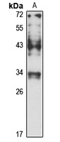 PDCL Rabbit Polyclonal Antibody