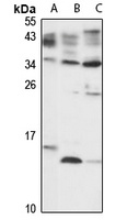 PDE6D Rabbit Polyclonal Antibody