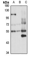 PDE7A Rabbit Polyclonal Antibody