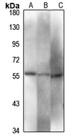 PDIA2 Rabbit Polyclonal Antibody