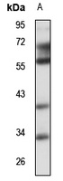 PDSS2 Rabbit Polyclonal Antibody