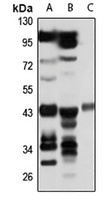 PELO Rabbit Polyclonal Antibody