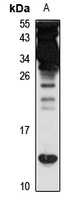 Prefoldin 6 Rabbit Polyclonal Antibody