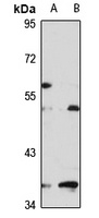 PISD Rabbit Polyclonal Antibody
