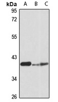 Pitx2 Rabbit Polyclonal Antibody