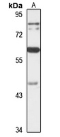 PLAGL2 Rabbit Polyclonal Antibody
