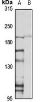 Plexin B1 Rabbit Polyclonal Antibody
