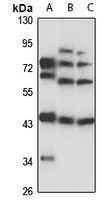 POU3F4 Rabbit Polyclonal Antibody