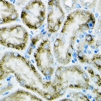 PGC1 alpha Rabbit Polyclonal Antibody