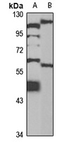 WIP1 Rabbit Polyclonal Antibody