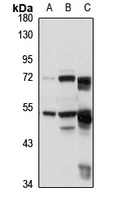 PPP2R5E Rabbit Polyclonal Antibody