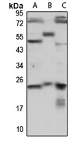 PRKRIP1 Antibody