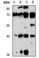 PRSS23 Rabbit Polyclonal Antibody
