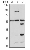 PSMC1 Rabbit Polyclonal Antibody