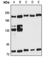 PSME4 Rabbit Polyclonal Antibody